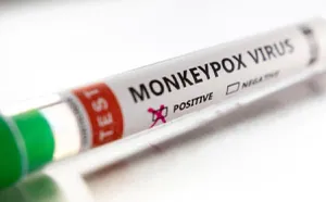 OMS modifica nombre de viruela del mono a ‘mpox’